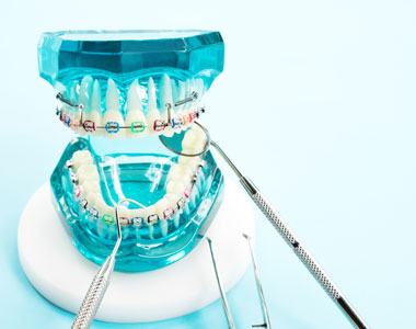 Benefits of Braces- treatment at gardencity  