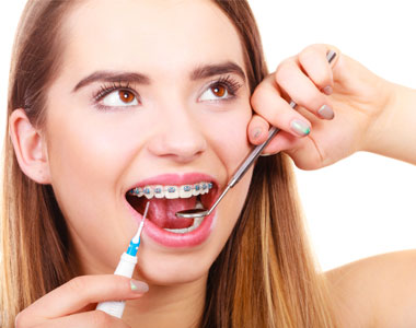 how to keep braces clean