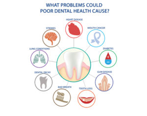 Connection between oral and Physical Health