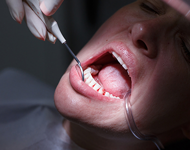 Facts you should know about Gum Disease- treatment at gardencity  