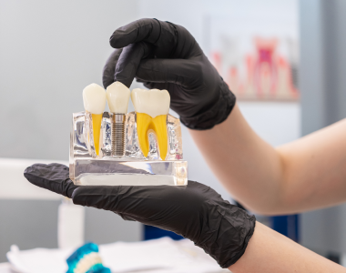 What to Expect from a Dental Implant- treatment at gardencity  