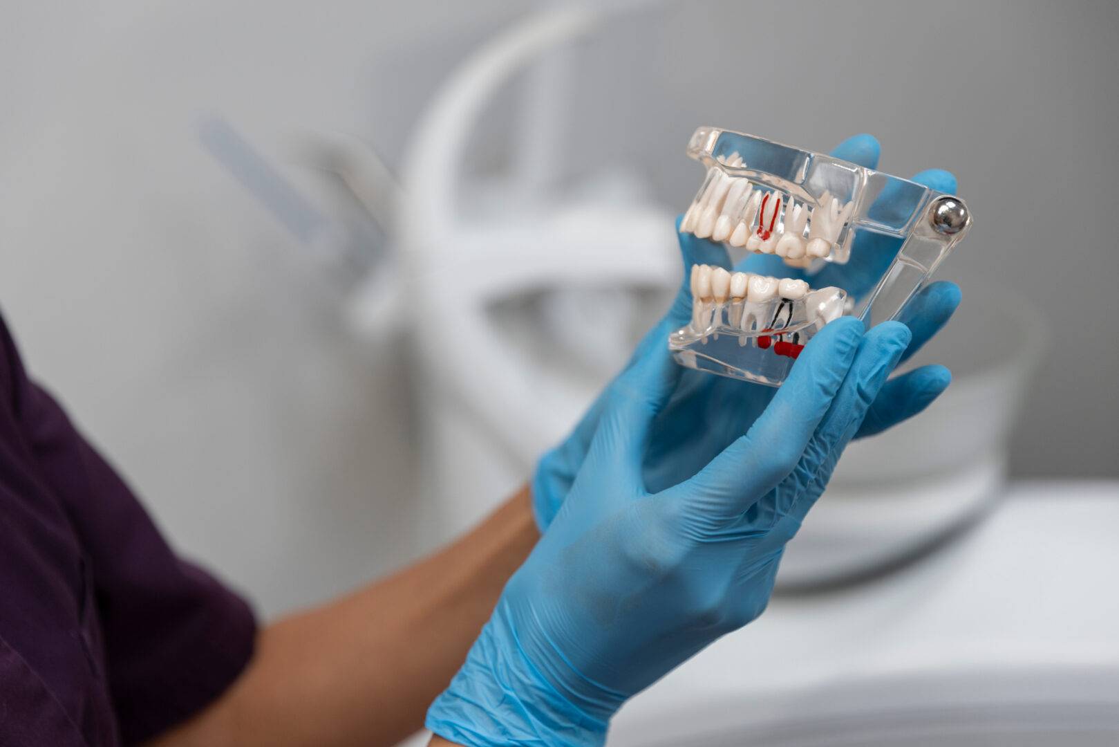 Clouse up dental implant