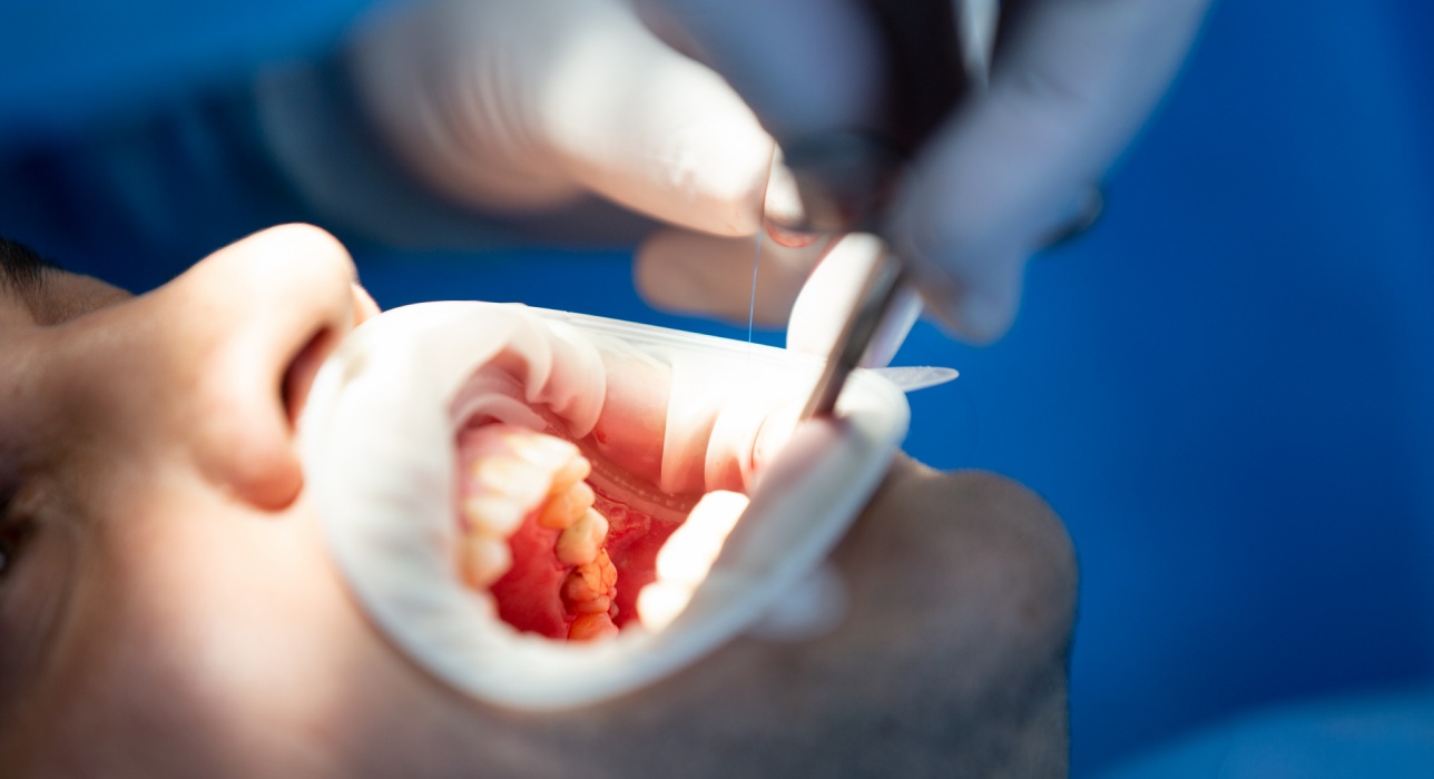 Professional periodontal cleaning consultation at Garden City Family Dentistry