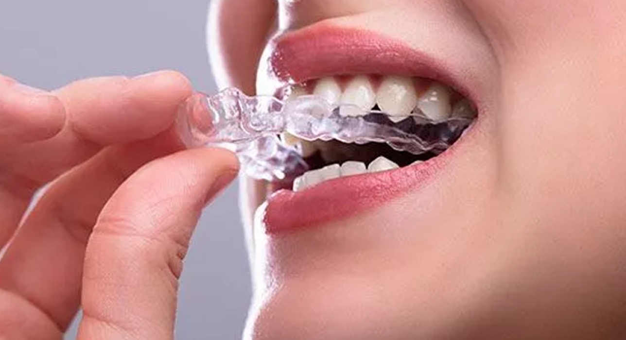 Custom sleep apnea oral appliance consultation at Garden City Family Dentistry